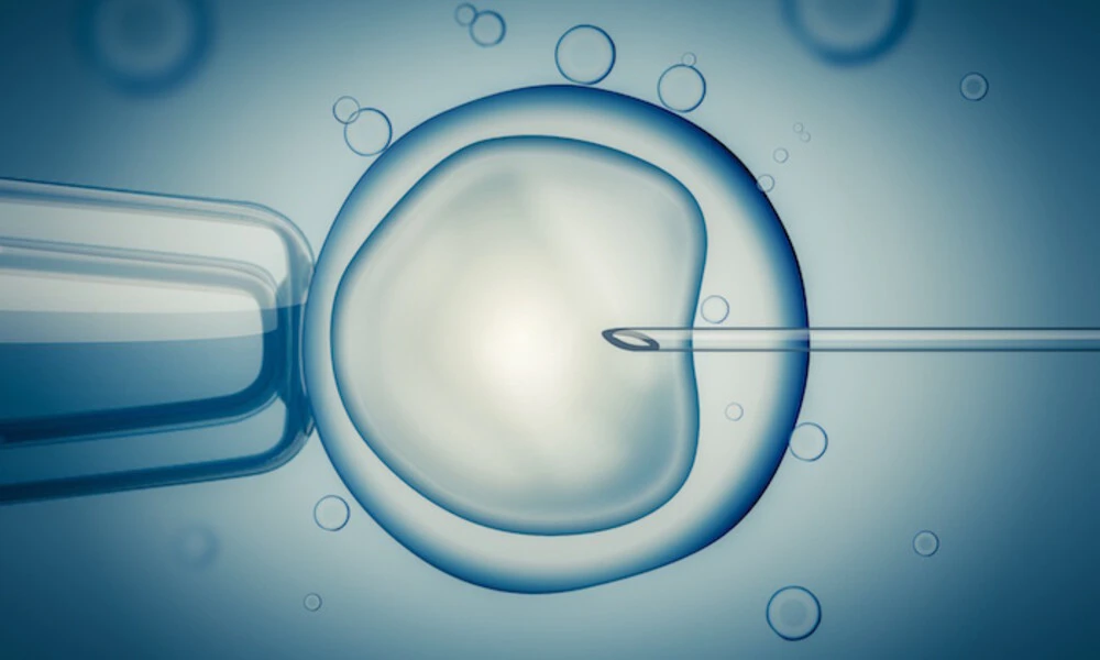The first in vitro fertilization: the birth of Louise Brown and a new scientific era